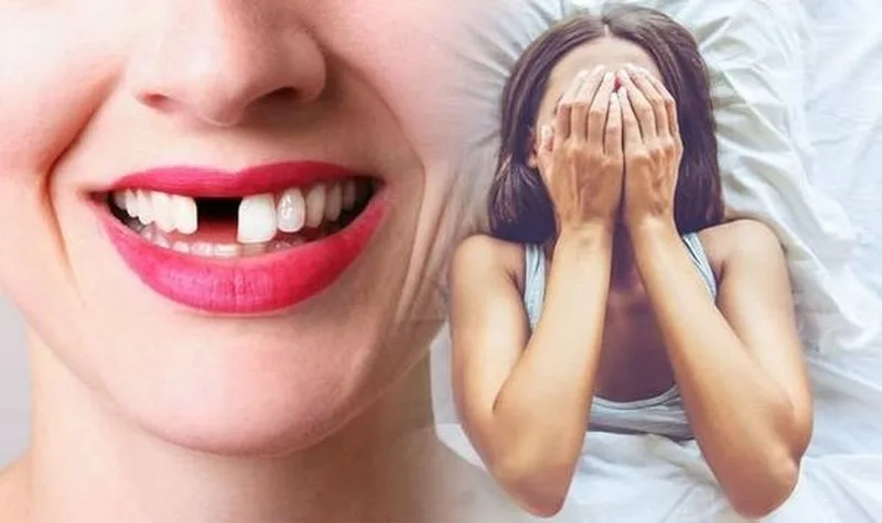Nằm Mơ Thấy Rụng Răng Là Điềm Gì? Giải Mã Tâm Linh Chuẩn Xác